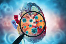 best prevention for kidney disease doctor in mulund thane